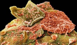 老挝酸菜爆料图片高清视频,揭秘高清视频中的酸辣美味与独特风情